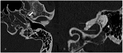 Frontiers Comparison Of Radiological Abnormalities Between The